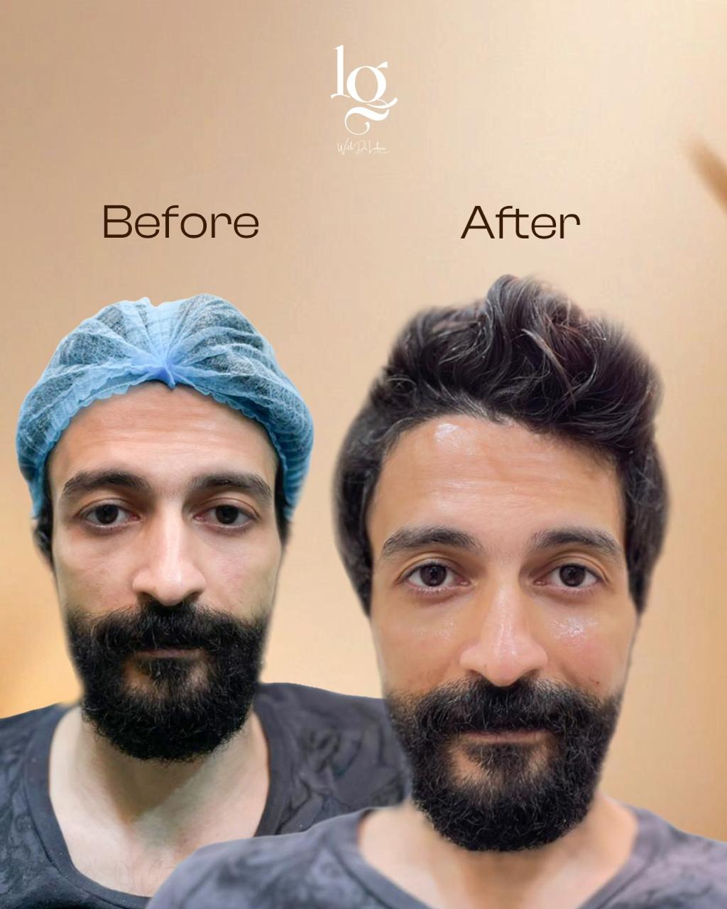 Treatment Result